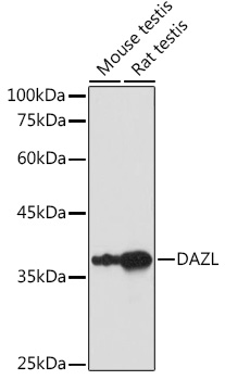 Western blot analysis of extracts of various cell lines using DAZL Polyclonal Antibody at 1:1000 dilution.