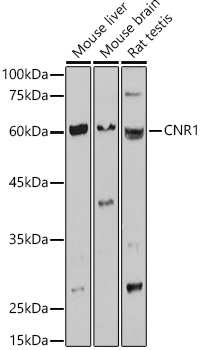 Western blot analysis of extracts of various cell lines using CNR1 Polyclonal Antibody at 1:1000 dilution.