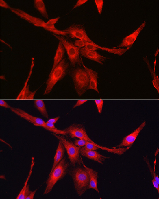 Immunofluorescence analysis of PC-12 cells using [KO Validated] Glutathione Synthetase (GSS) Polyclonal antibody at dilution of 1:100 (40x lens). Blue: DAPI for nuclear staining.