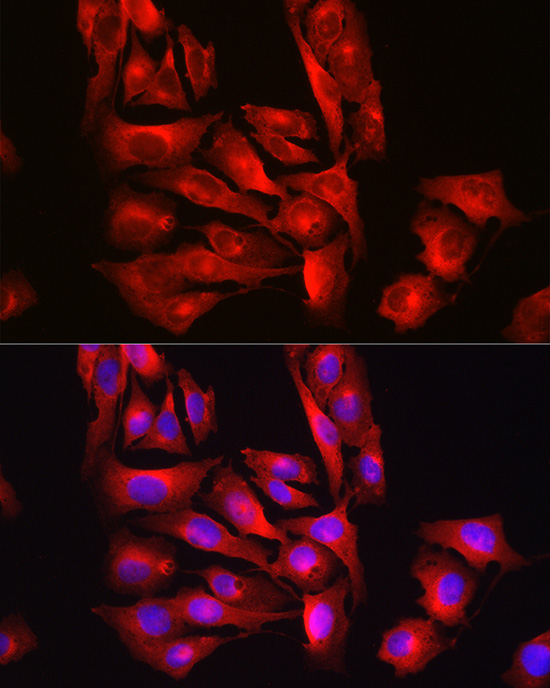 Immunofluorescence analysis of U2OS cells using [KO Validated] Glutathione Synthetase (GSS) Polyclonal antibody at dilution of 1:100 (40x lens). Blue: DAPI for nuclear staining.