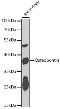 Western blot analysis of extracts of Rat kidney using Osteopontin Polyclonal Antibody at 1:1000 dilution.