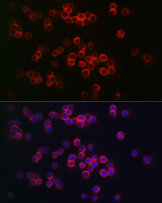 Immunofluorescence analysis of THP-1 cells using CD68 Polyclonal Antibody at dilution of 1:150 (40x lens). Blue: DAPI for nuclear staining.