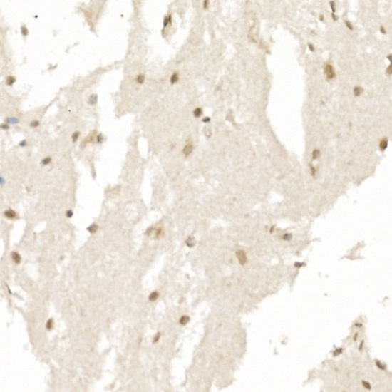 Immunohistochemistry of paraffin-embedded Human brain using Survivin Polyclonal Antibody at dilution of 1:25 (40x lens).Perform high pressure antigen retrieval with 10 mM citrate buffer pH 6.0 before commencing with IHC staining protocol.