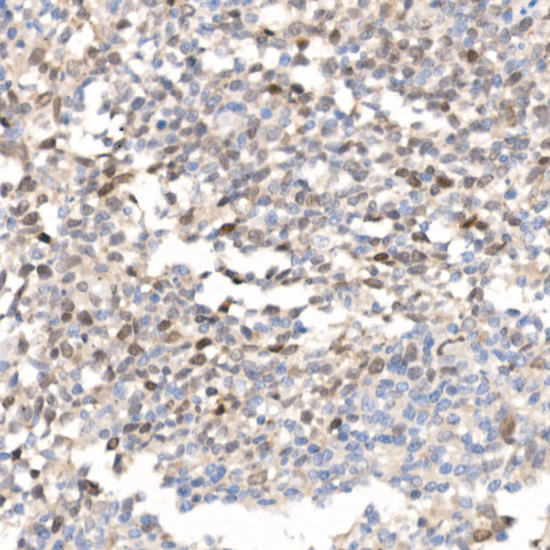 Immunohistochemistry of paraffin-embedded human tonsil using Survivin Polyclonal antibody at dilution of 1:25 (40x lens).Perform high pressure antigen retrieval with 10 mM citrate buffer pH 6.0 before commencing with IHC staining protocol.