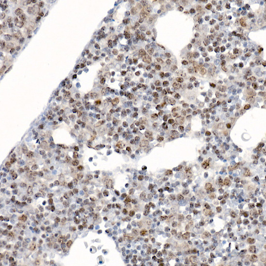 Immunohistochemistry of paraffin-embedded mouse fetal liver using Survivin Polyclonal antibody at dilution of 1:25 (40x lens).Perform high pressure antigen retrieval with 10 mM citrate buffer pH 6.0 before commencing with IHC staining protocol.