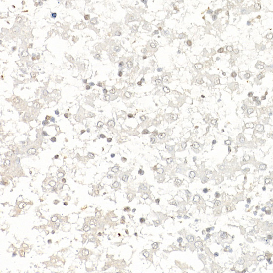 Immunohistochemistry of paraffin-embedded rat fetal liver using Survivin Polyclonal antibody at dilution of 1:25 (40x lens).Perform high pressure antigen retrieval with 10 mM citrate buffer pH 6.0 before commencing with IHC staining protocol.