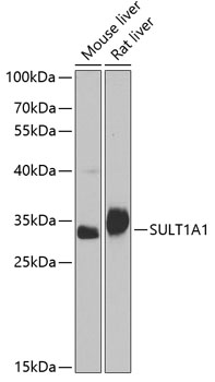 Western blot analysis of extracts of various cell lines using SULT1A1 Polyclonal Antibody at 1:1000 dilution.