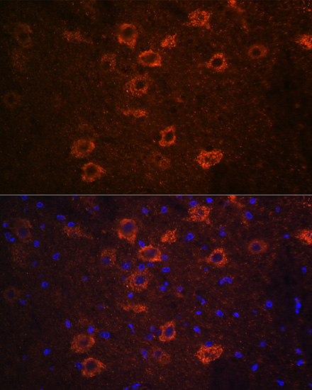 Immunofluorescence analysis of mouse brain using SLC18A3 Polyclonal Antibody at dilution of 1:100 (40x lens). Blue: DAPI for nuclear staining.