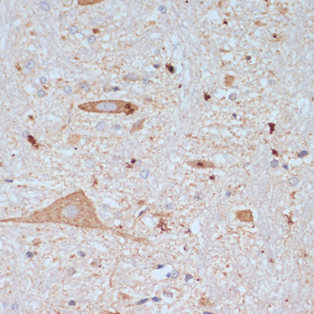 Immunohistochemistry of paraffin-embedded rat brain using SLC18A3 Polyclonal Antibody at dilution of 1:200 (40x lens).Perform microwave antigen retrieval with 10 mM PBS buffer pH 7.2 before commencing with IHC staining protocol.