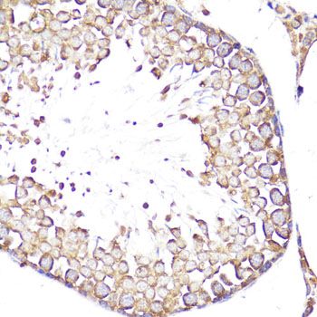 Immunohistochemistry of paraffin-embedded rat testis using CD62L/L-Selectin Polyclonal antibody at dilution of 1:100 (40x lens).Perform microwave antigen retrieval with 10 mM PBS buffer pH 7.2 before commencing with IHC staining protocol.