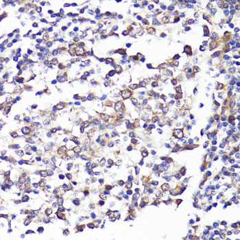 Immunohistochemistry of paraffin-embedded human tonsil using CD62L/L-Selectin Polyclonal antibody at dilution of 1:100 (40x lens).Perform microwave antigen retrieval with 10 mM PBS buffer pH 7.2 before commencing with IHC staining protocol.