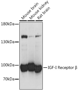 Western blot analysis of extracts of various cell lines using IGF1R Polyclonal Antibody at 1:1000 dilution.