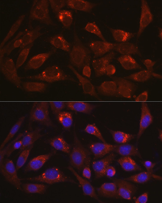 Immunofluorescence analysis of BALA-3T3 cells using LAMP1 Polyclonal antibody at dilution of 1:100 (40x lens). Blue: DAPI for nuclear staining.