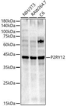 Western blot analysis of various lysates using P2RY12 Polyclonal Antibody at 1:400 dilution.