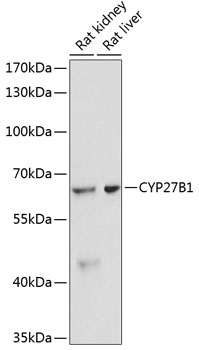 Western blot analysis of extracts of various cell lines using CYP27B1 Polyclonal Antibody at 1:3000 dilution.