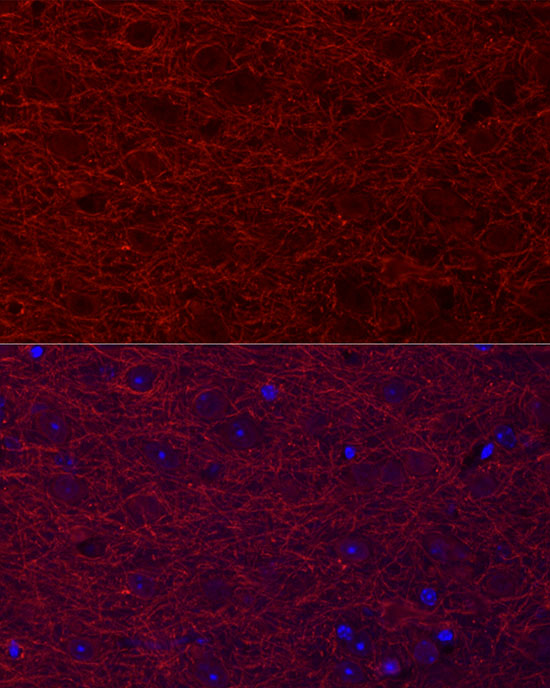 Immunofluorescence analysis of mouse brain cells using MAP2 Polyclonal antibody at dilution of 1:25 (40x lens). Blue: DAPI for nuclear staining.