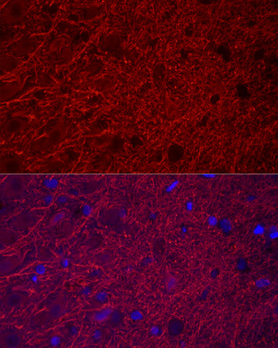 Immunofluorescence analysis of rat brain cells using MAP2 Polyclonal antibody at dilution of 1:25 (40x lens). Blue: DAPI for nuclear staining.