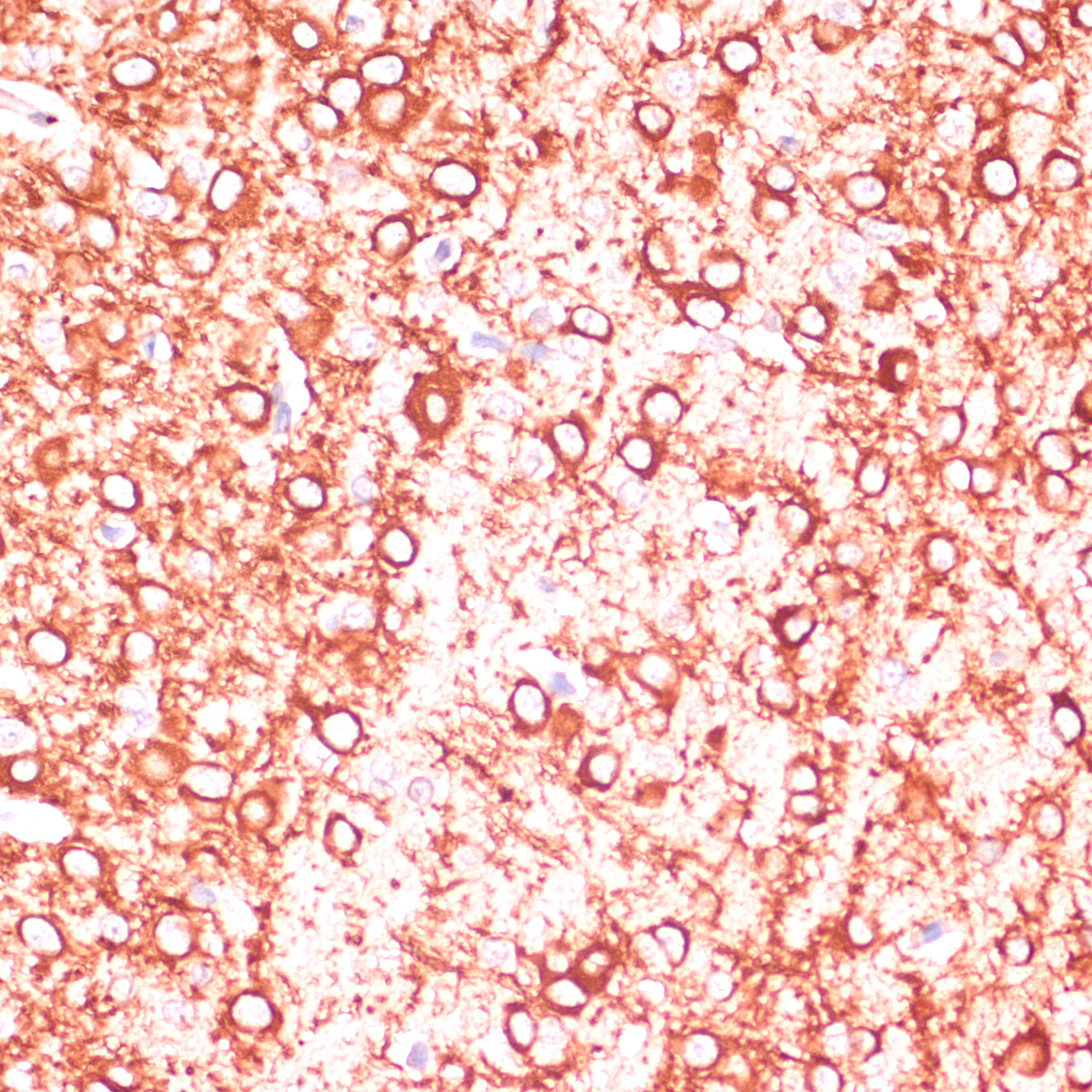 Immunohistochemistry of paraffin-embedded Rat brain using MAP2 Polyclonal Antibody at dilution of 1:100 (40x lens).Perform microwave antigen retrieval with 10 mM PBS buffer pH 7.2 before commencing with IHC staining protocol.