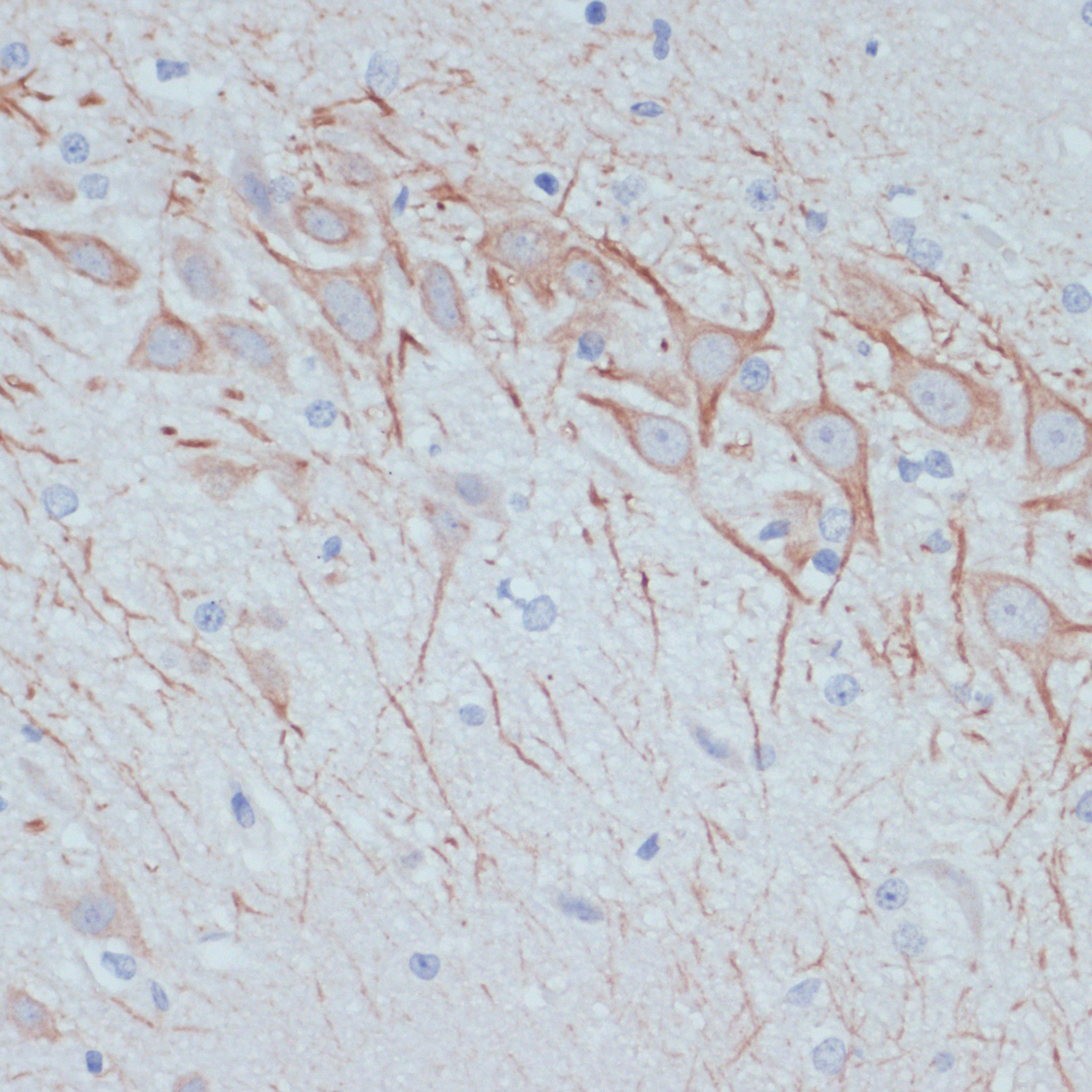 Immunohistochemistry of paraffin-embedded Rat brain using MAP2 Polyclonal antibody at dilution of 1:100 (40x lens).Perform microwave antigen retrieval with 10 mM PBS buffer pH 7.2 before commencing with IHC staining protocol.