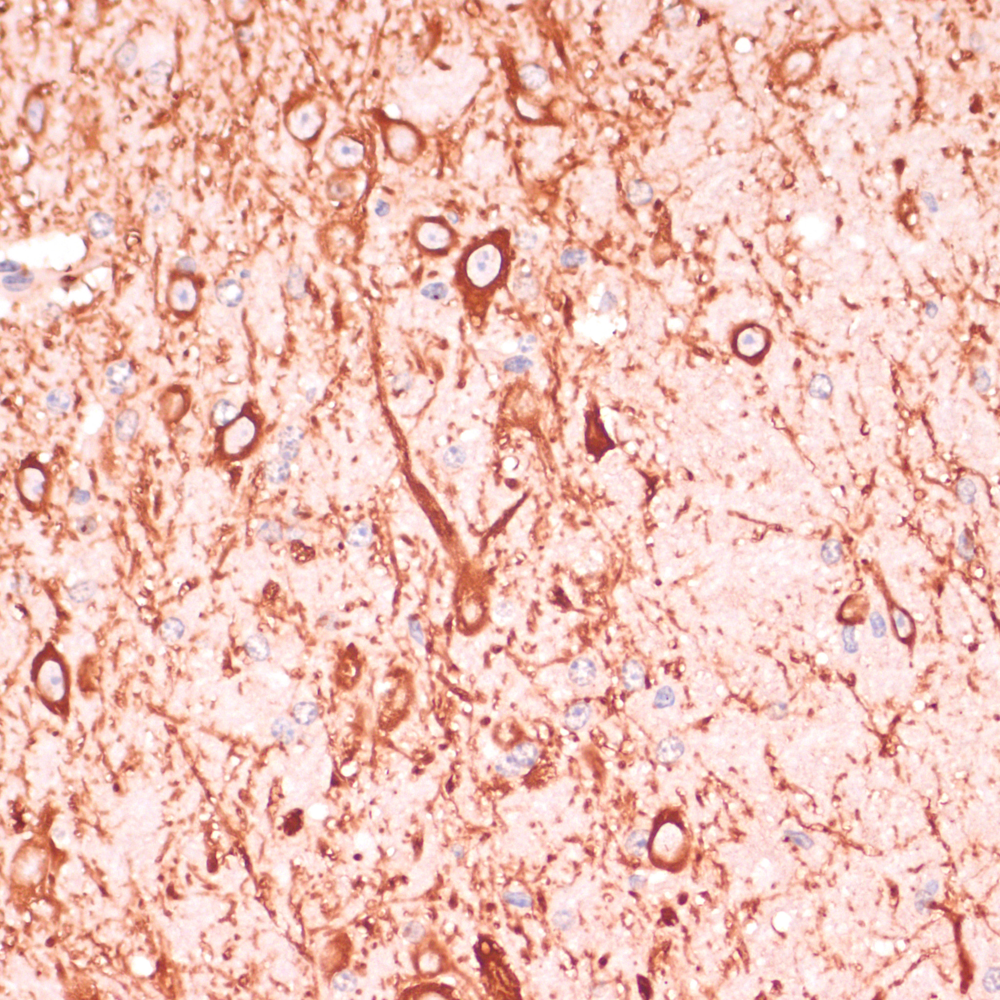 Immunohistochemistry of paraffin-embedded Mouse brain using MAP2 Polyclonal antibody at dilution of 1:100 (40x lens).Perform microwave antigen retrieval with 10 mM PBS buffer pH 7.2 before commencing with IHC staining protocol.