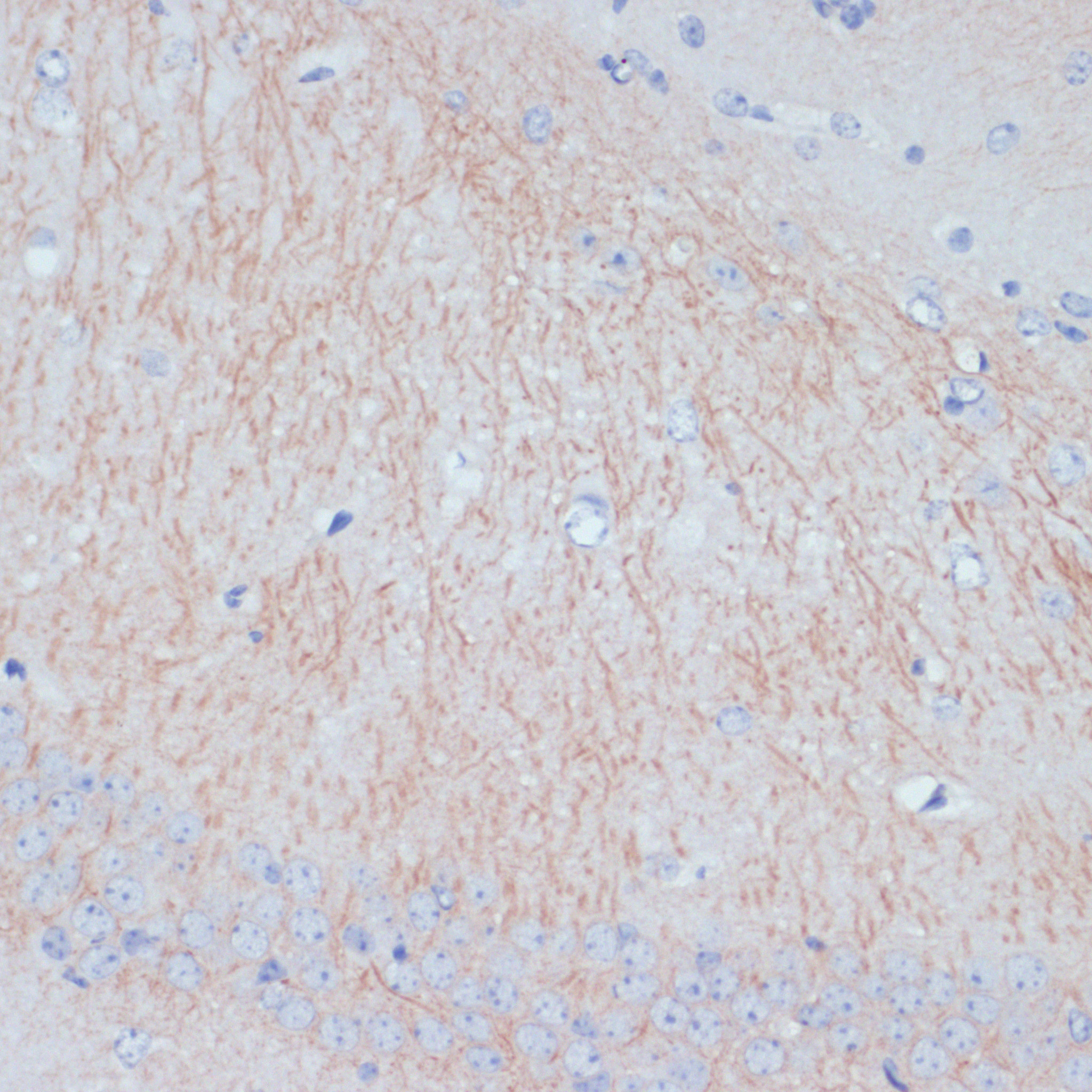 Immunohistochemistry of paraffin-embedded Mouse brain using MAP2 Polyclonal antibody at dilution of 1:100 (40x lens).Perform microwave antigen retrieval with 10 mM PBS buffer pH 7.2 before commencing with IHC staining protocol.