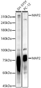Western blot analysis of various lysates using MAP2 Polyclonal Antibody at 1:2000 dilution.
