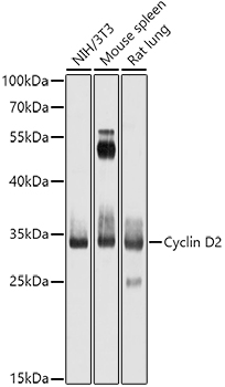 Western blot analysis of extracts of various cell lines using Cyclin D2 Polyclonal Antibody at 1:1000 dilution.