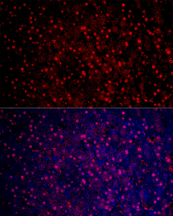 Immunofluorescence analysis of human liver cancer cells using Arginase 1  (ARG1) Polyclonal Antibody at dilution of 1:50 (40x lens). Blue: DAPI for nuclear staining.