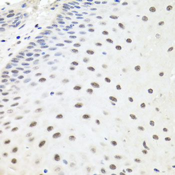 Immunohistochemistry of paraffin-embedded human esophagus using EXO1 Polyclonal antibody at dilution of 1:100 (40x lens).Perform microwave antigen retrieval with 10 mM PBS buffer pH 7.2 before commencing with IHC staining protocol.