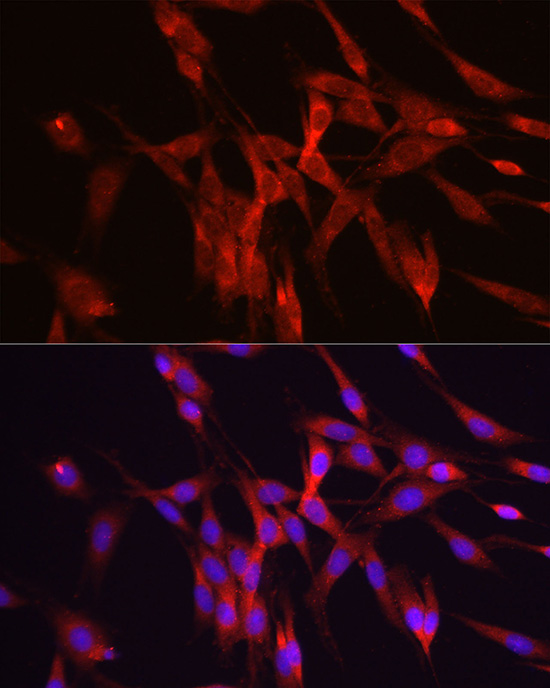 Immunofluorescence analysis of PC-12 cells using ODC1 Polyclonal antibody at dilution of 1:50 (40x lens). Blue: DAPI for nuclear staining.