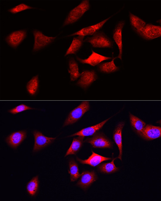 Immunofluorescence analysis of U2OS cells using ODC1 Polyclonal antibody at dilution of 1:50 (40x lens). Blue: DAPI for nuclear staining.