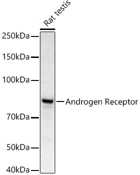 Western blot analysis of extracts of Rat testis using Androgen Receptor Polyclonal Antibody at 1:500dilution.