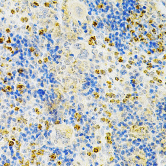 Immunohistochemistry of paraffin-embedded mouse spleen using TNFRSF11B Polyclonal antibody at dilution of 1:200 (40x lens).Perform microwave antigen retrieval with 10 mM PBS buffer pH 7.2 before commencing with IHC staining protocol.