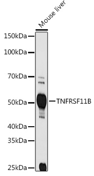 Western blot analysis of extracts of Mouse liver using TNFRSF11B Polyclonal Antibody at 1:1000 dilution.