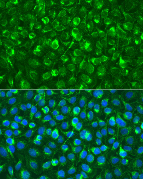 Immunofluorescence analysis of U2OS using Syk Polyclonal antibody at dilution of 1:100 (40x lens). Blue: DAPI for nuclear staining.