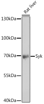 Western blot analysis of extracts of Rat liver using Syk Polyclonal Antibody at 1:500 dilution.