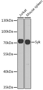 Western blot analysis of extracts of various cell lines using Syk Polyclonal Antibody at 1:1000 dilution.