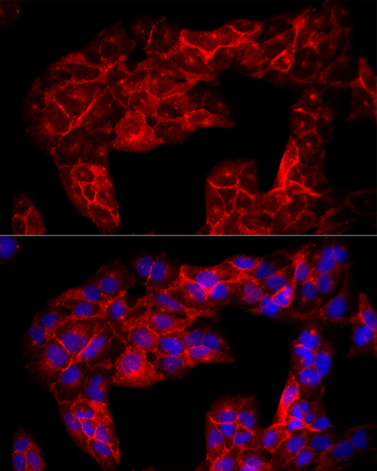 Immunofluorescence analysis of U2OS cells using CD90/Thy1 Polyclonal Antibody at dilution of 1:50 (40x lens). Blue: DAPI for nuclear staining.