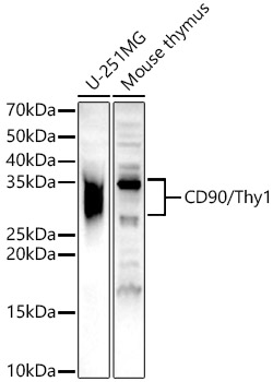 Western blot analysis of various lysates using CD90/Thy1 Polyclonal Antibody at 1:500 dilution.
