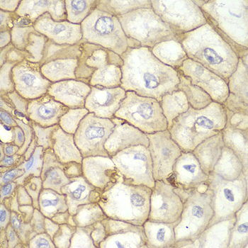 Immunohistochemistry of paraffin-embedded human esophagus using HLA-A Polyclonal antibody at dilution of 1:100 (40x lens).Perform microwave antigen retrieval with 10 mM PBS buffer pH 7.2 before commencing with IHC staining protocol.