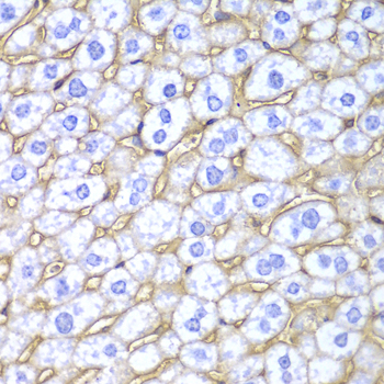 Immunohistochemistry of paraffin-embedded mouse liver using HLA-A Polyclonal antibody at dilution of 1:100 (40x lens).Perform microwave antigen retrieval with 10 mM PBS buffer pH 7.2 before commencing with IHC staining protocol.