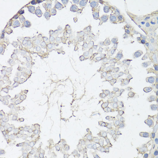 Immunohistochemistry of paraffin-embedded rat testis using MRP4/ABCC4 Polyclonal Antibody at dilution of 1:150 (40x lens).Perform microwave antigen retrieval with 10 mM PBS buffer pH 7.2 before commencing with IHC staining protocol.