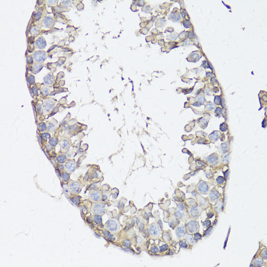 Immunohistochemistry of paraffin-embedded mouse testis using MRP4/ABCC4 Polyclonal antibody at dilution of 1:150 (40x lens).Perform microwave antigen retrieval with 10 mM PBS buffer pH 7.2 before commencing with IHC staining protocol.