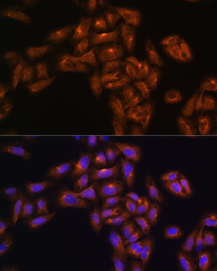 Immunofluorescence analysis of U-251MG cells using ALIX / PDCD6IP Polyclonal antibody at dilution of 1:100. Blue: DAPI for nuclear staining.