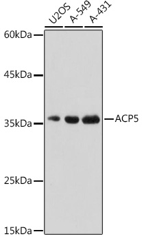 Western blot analysis of extracts of various cell lines using ACP5 Polyclonal Antibody at 1:500 dilution.