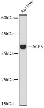 Western blot analysis of extracts of Rat liver using ACP5 Polyclonal Antibody at 1:1000 dilution.