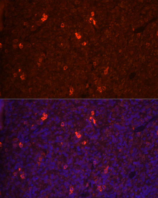 Immunofluorescence analysis of rat spleen cells using RANKL Polyclonal antibody at dilution of 1:100 (40x lens). Blue: DAPI for nuclear staining.