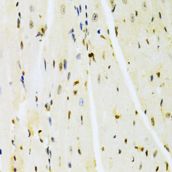 Immunohistochemistry of paraffin-embedded mouse heart using HMGB1 Polyclonal antibody at dilution of 1:100 (40x lens).Perform microwave antigen retrieval with 10 mM PBS buffer pH 7.2 before commencing with IHC staining protocol.