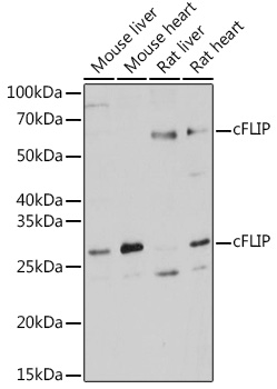 Western blot analysis of extracts of various cell lines using cFLIP Polyclonal Antibody at 1:1000 dilution.