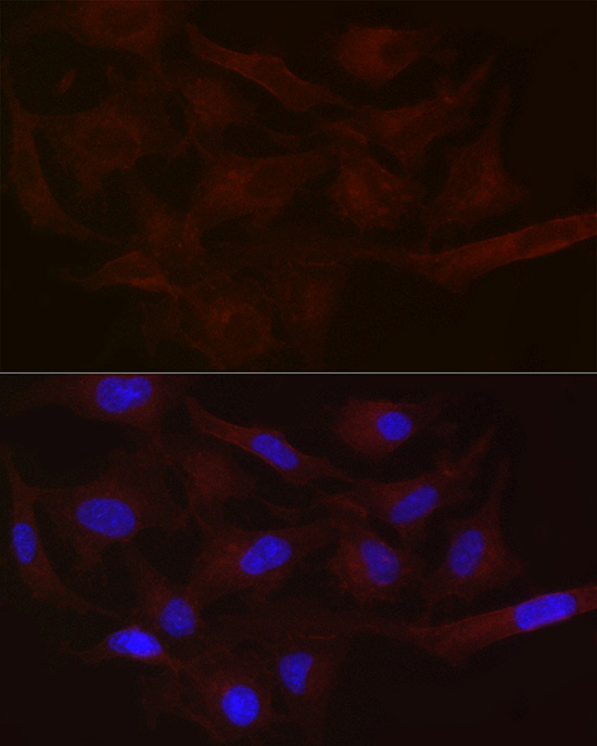 Immunofluorescence analysis of HeLa cells using MCT1/SLC16A1 Polyclonal antibody at dilution of 1:100 (40x lens). Blue: DAPI for nuclear staining.